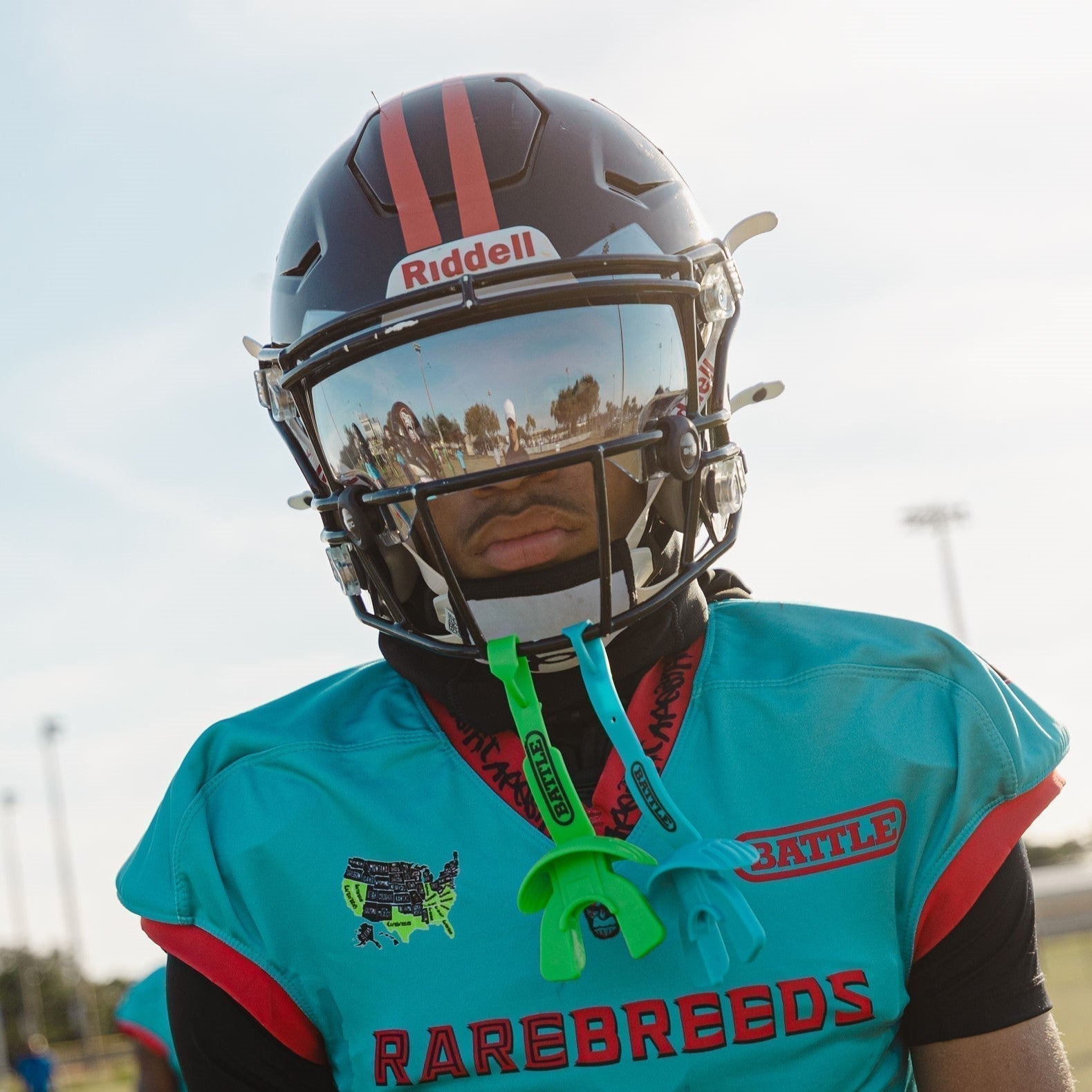 Lip Guard vs. Mouthguard: Differences & How to Choose